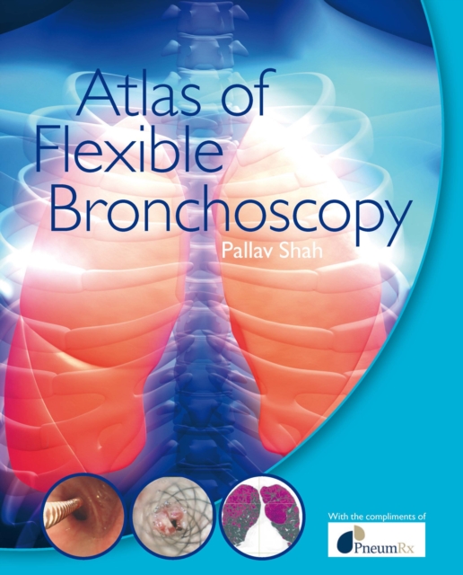 Atlas of Flexible Bronchoscopy, PDF eBook