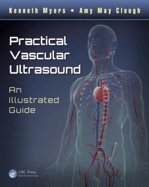 Practical Vascular Ultrasound : An Illustrated Guide, Paperback / softback Book