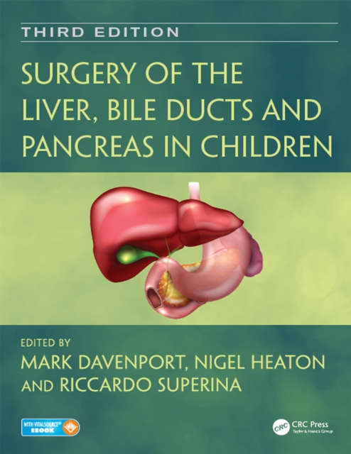 Surgery of the Liver, Bile Ducts and Pancreas in Children, PDF eBook