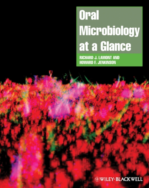 Oral Microbiology at a Glance, PDF eBook