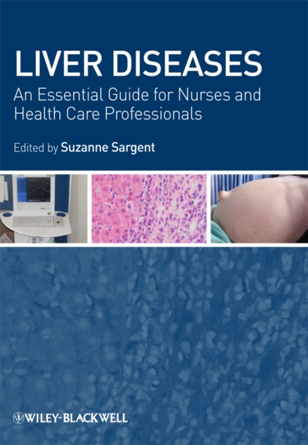 Liver Diseases : An Essential Guide for Nurses and Health Care Professionals, PDF eBook