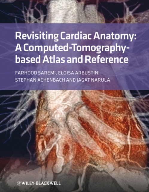 Revisiting Cardiac Anatomy : A Computed-Tomography-Based Atlas and Reference, PDF eBook