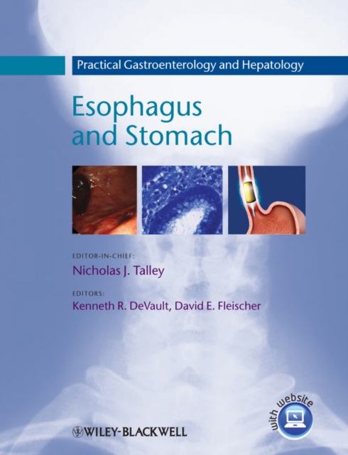 Practical Gastroenterology and Hepatology : Esophagus and Stomach, PDF eBook