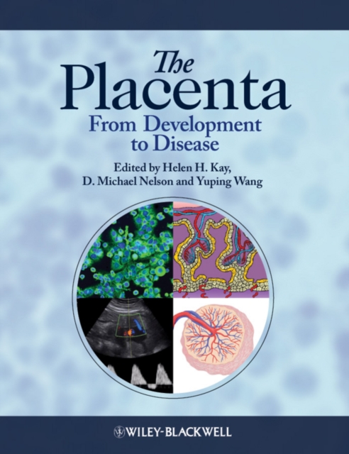 The Placenta : From Development to Disease, Hardback Book