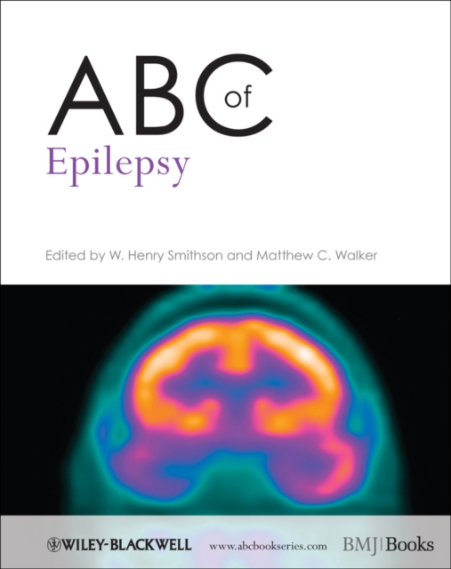 ABC of Epilepsy, Paperback / softback Book