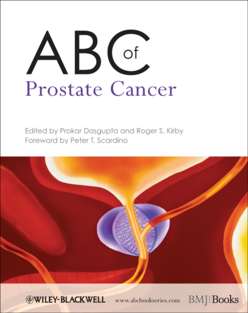 ABC of Prostate Cancer, Paperback / softback Book