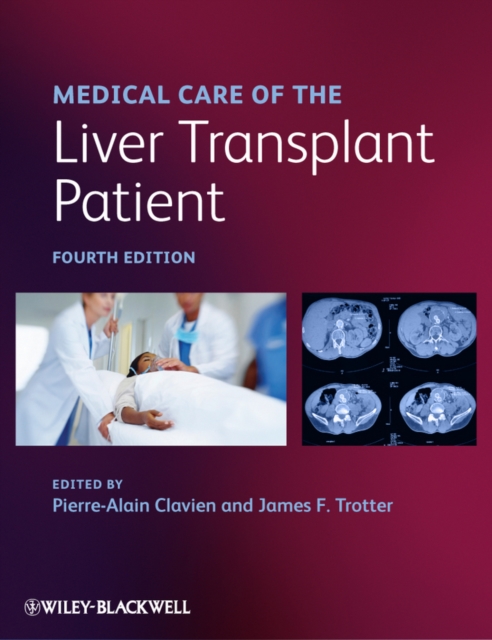 Medical Care of the Liver Transplant Patient, Hardback Book