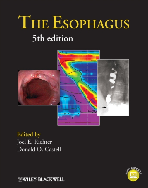 The Esophagus, EPUB eBook