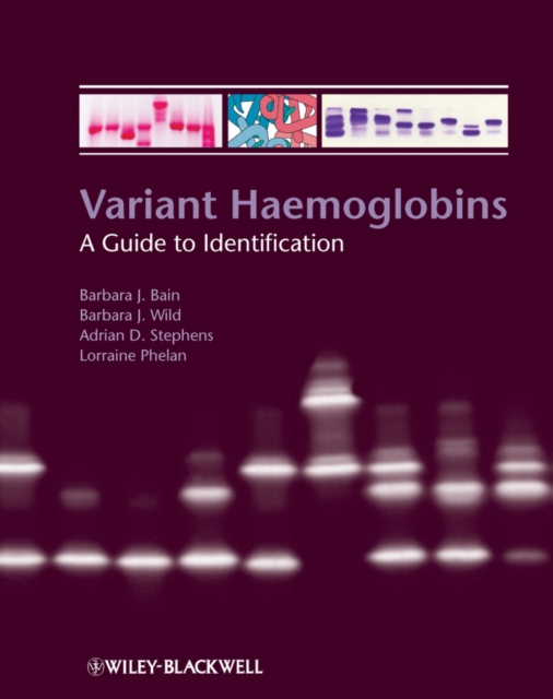 Variant Haemoglobins : A Guide to Identification, EPUB eBook