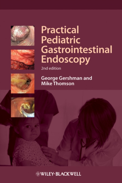 Practical Pediatric Gastrointestinal Endoscopy, EPUB eBook