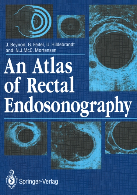 An Atlas of Rectal Endosonography, PDF eBook