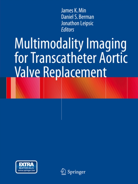 Multimodality Imaging for Transcatheter Aortic Valve Replacement, PDF eBook