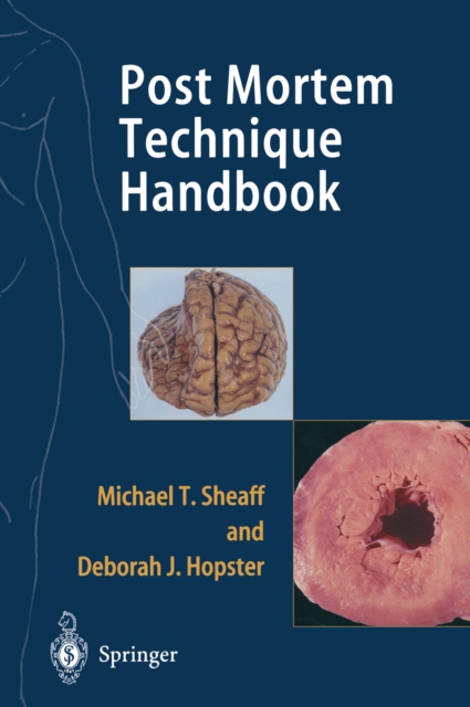 Post Mortem Technique Handbook, PDF eBook