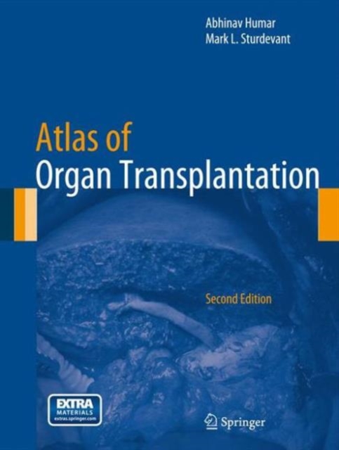 Atlas of Organ Transplantation, Hardback Book