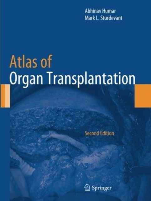Atlas of Organ Transplantation, Paperback / softback Book