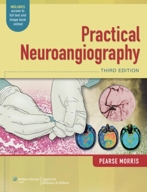Practical Neuroangiography, Hardback Book