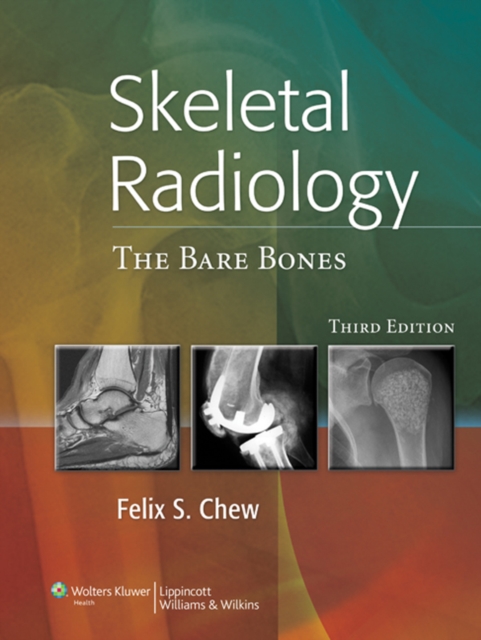 Skeletal Radiology : The Bare Bones, EPUB eBook