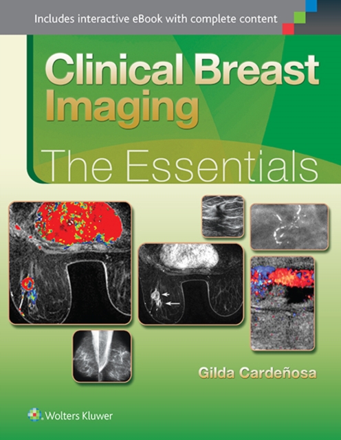 Clinical Breast Imaging: The Essentials, Hardback Book