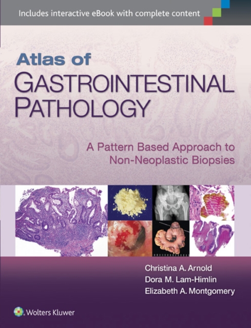 Atlas of Gastrointestinal Pathology : A Pattern Based Approach to Non-Neoplastic Biopsies, Hardback Book