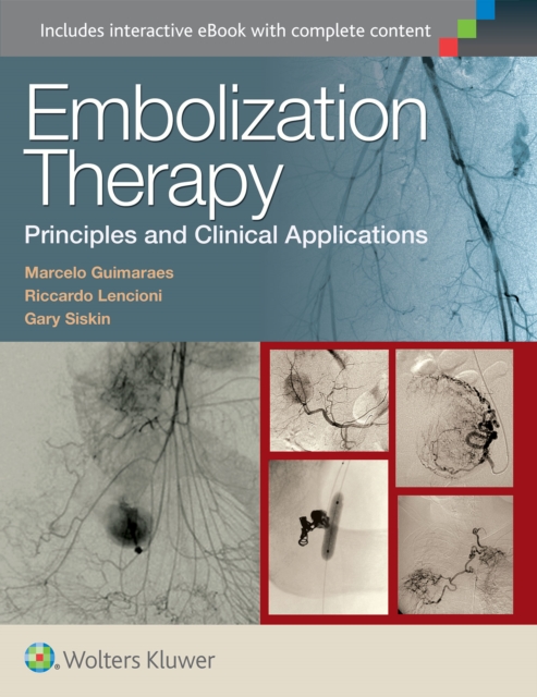 Embolization Therapy: Principles and Clinical Applications, Hardback Book