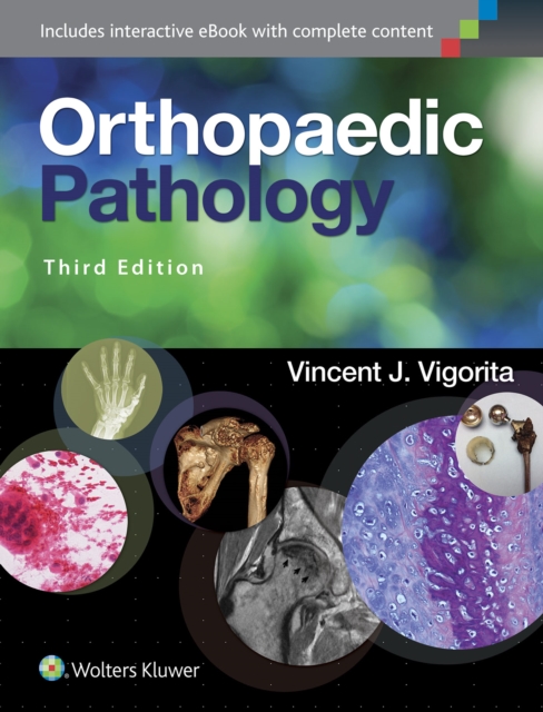 Orthopaedic Pathology, Hardback Book