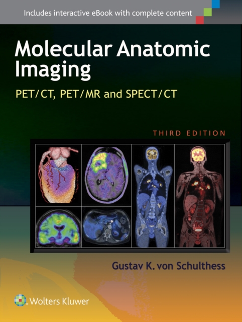 Molecular Anatomic Imaging : PET/CT, PET/MR and SPECT CT, Hardback Book