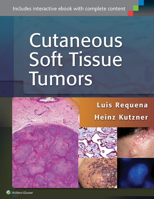 Cutaneous Soft Tissue Tumors, Hardback Book