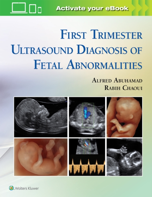First Trimester Ultrasound Diagnosis of Fetal Abnormalities, Hardback Book
