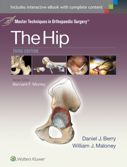 Master Techniques in Orthopaedic Surgery: The Hip, Hardback Book