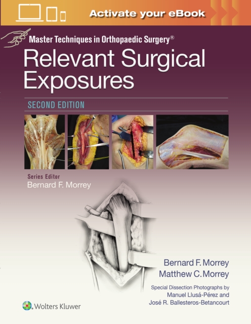 Master Techniques in Orthopaedic Surgery: Relevant Surgical Exposures, Hardback Book