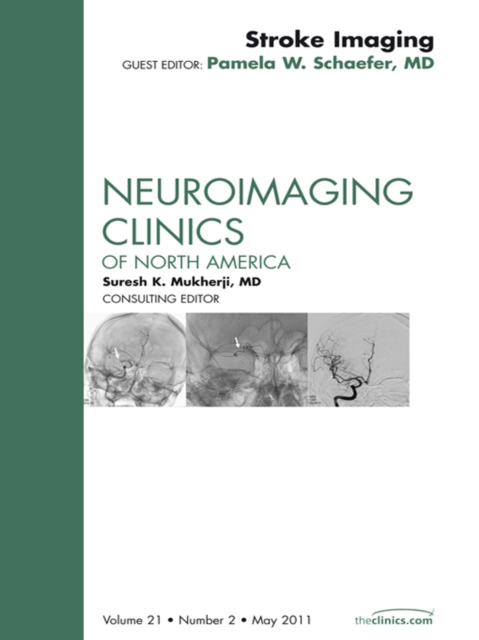 Imaging of Ischemic Stroke, An Issue of Neuroimaging Clinics : Imaging of Ischemic Stroke, An Issue of Neuroimaging Clinics, EPUB eBook