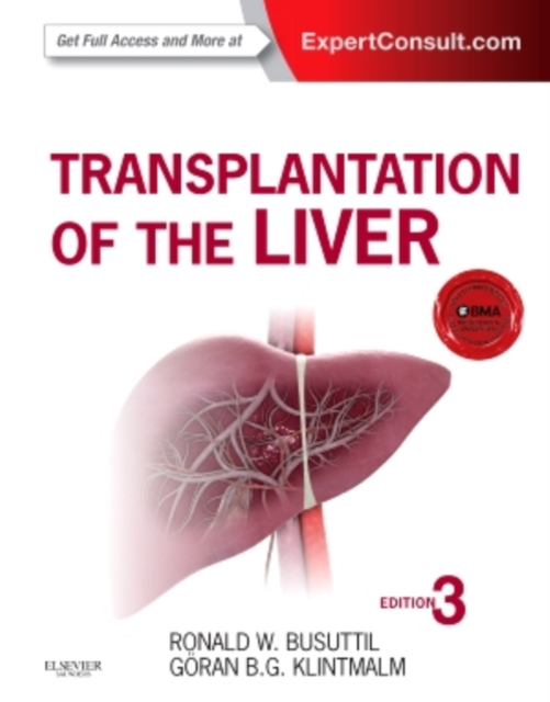 Transplantation of the Liver, Hardback Book