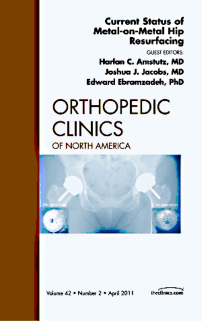 Current Status of Metal-on-Metal Hip Resurfacing, An Issue of Orthopedic Clinics : Volume 42-2, Hardback Book