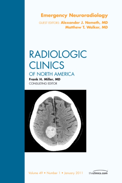 Emergency Neuroradiology, An Issue of Radiologic Clinics of North America : Volume 49-1, Hardback Book