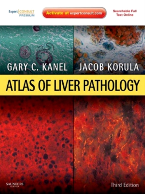 Atlas of Liver Pathology E-Book : Expert Consult - Online and Print, EPUB eBook