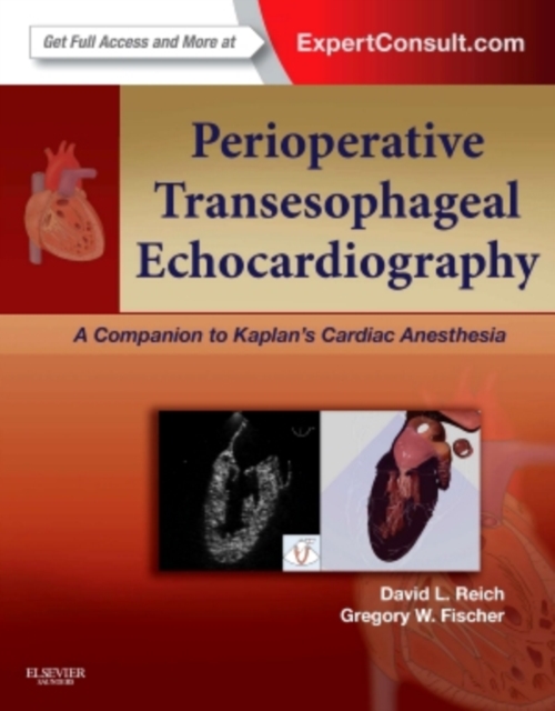 Perioperative Transesophageal Echocardiography : A Companion to Kaplan's Cardiac Anesthesia (Expert Consult: Online and Print), Hardback Book