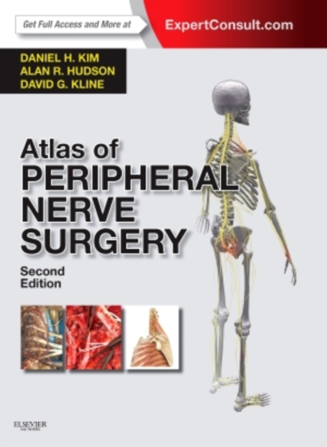 Atlas of Peripheral Nerve Surgery : Expert Consult - Online and Print, Hardback Book