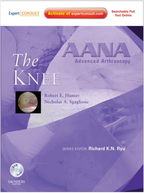 AANA Advanced Arthroscopy: The Knee : Expert Consult: Online, Print and DVD, EPUB eBook