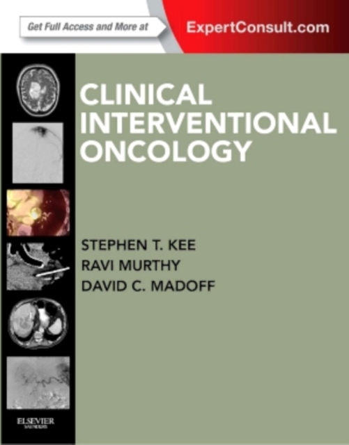 Clinical Interventional Oncology : Expert Consult - Online and Print, Hardback Book