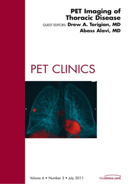 PET Imaging of Thoracic Disease, An Issue of PET Clinics, EPUB eBook
