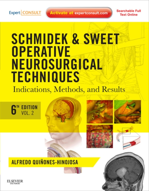 Schmidek and Sweet: Operative Neurosurgical Techniques E-Book : Indications, Methods and Results (Expert Consult - Online and Print), EPUB eBook