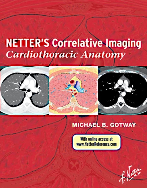 Netter's Correlative Imaging: Cardiothoracic Anatomy, EPUB eBook