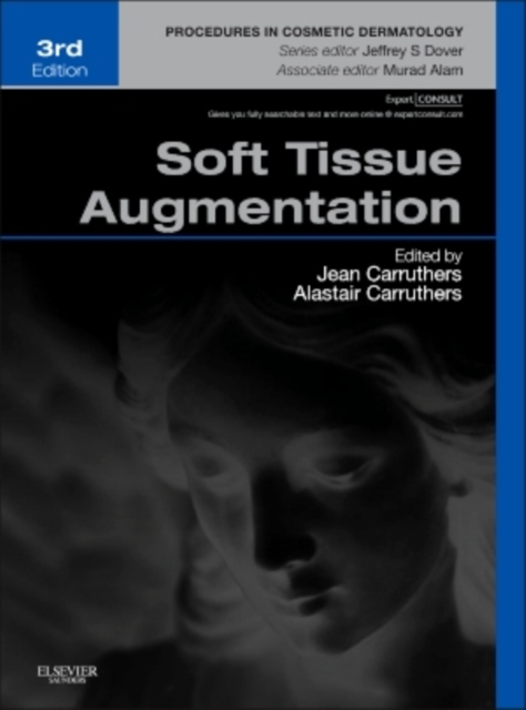 Soft Tissue Augmentation, Hardback Book