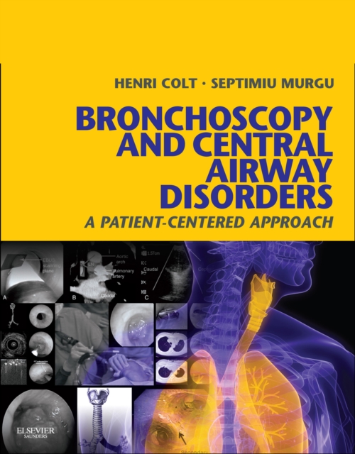Bronchoscopy and Central Airway Disorders E-Book : A Patient-Centered Approach: Expert Consult Online, EPUB eBook