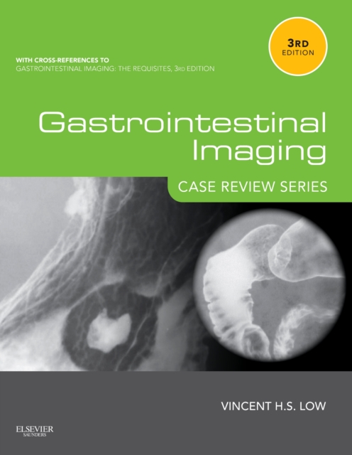 Gastrointestinal Imaging: Case Review Series E-Book, EPUB eBook