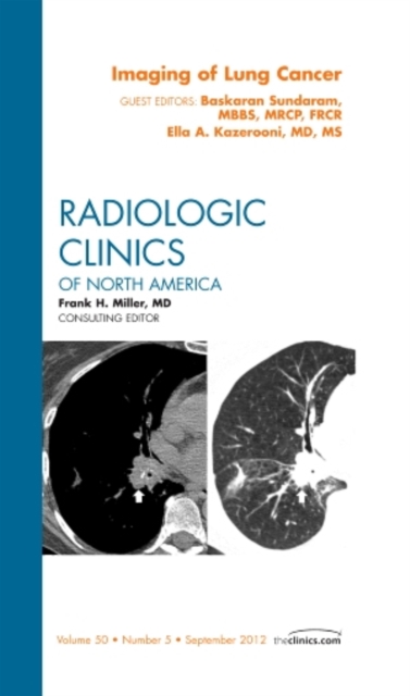 Imaging of Lung Cancer, An Issue of Radiologic Clinics of North America : Volume 50-5, Hardback Book