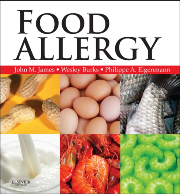 Food Allergy E-Book : Expert Consult Basic, EPUB eBook