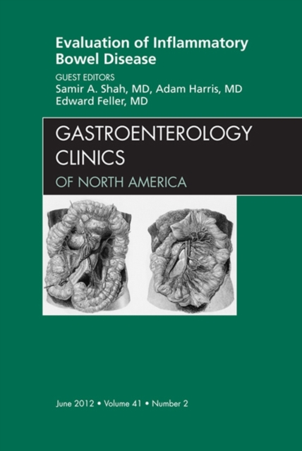 Evaluation of Inflammatory Bowel Disease, An Issue of Gastroenterology Clinics- : Evaluation of Inflammatory Bowel Disease, An Issue of Gastroenterology Clinics-, EPUB eBook