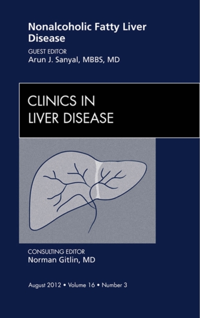 Nonalcoholic Fatty Liver Disease, An Issue of Clinics in Liver Disease, EPUB eBook