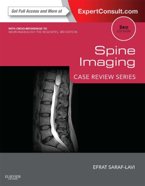 Spine Imaging: Case Review Series : Case Review Series (Expert Consult - Online), EPUB eBook